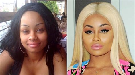 blac chyna before and after fame|Blac Chyna Compares Old Photos Before Removing。